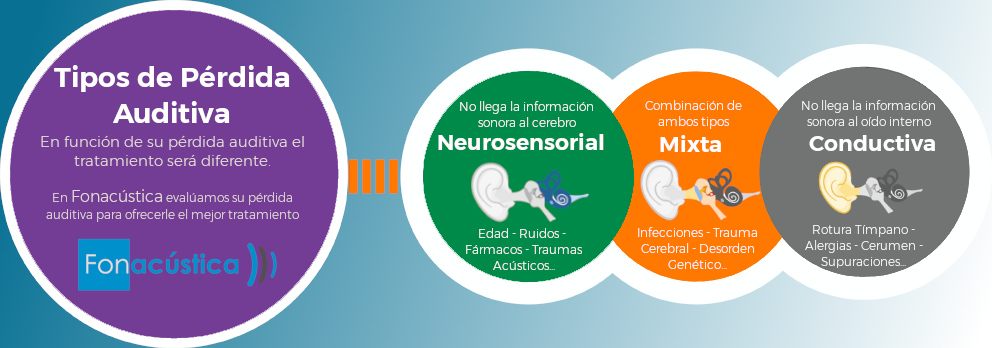 Tipos pérdida auditiva Tipos pérdida auditiva
